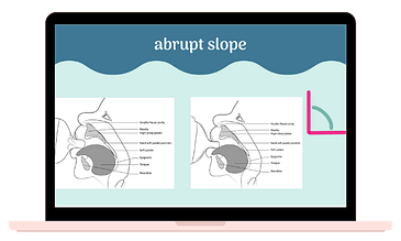laptop screen showing a slide about infant oral anatomy and baby bottles