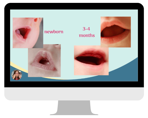 a computer screen showing images of babies' mouths at birth and at 3-4 months old