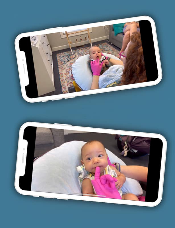 two cell phones with screen images of babies having oral exams performed
